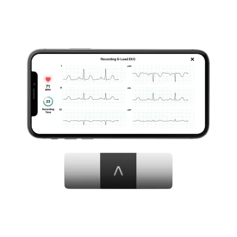 AliveCor thumbnail