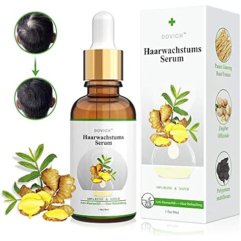 HOPEMATE H thumbnail